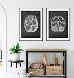 Gehirn im Schnitt - Chalkboard | Codex Anatomicus Fashion