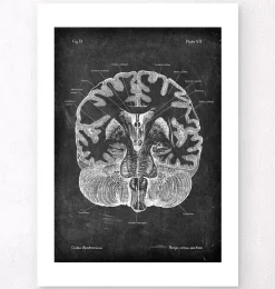 Gehirn im Schnitt - Chalkboard | Codex Anatomicus Fashion
