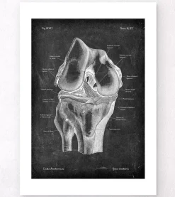 Knie Anatomie - Chalkboard | Codex Anatomicus Hot