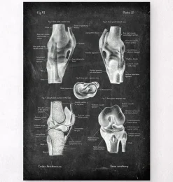 Knie Anatomie II - Chalkboard | Codex Anatomicus Clearance