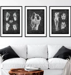 Knie Anatomie II - Chalkboard | Codex Anatomicus Clearance