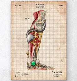 Mechanisches Bein | Codex Anatomicus Online
