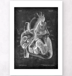 Präparierte Herz Anatomie II - Chalkboard | Codex Anatomicus Outlet